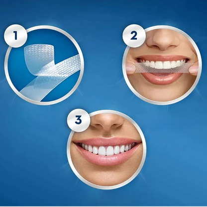 Crest 3D Whitestrips Professional Effects – Blanchiment Dentaire