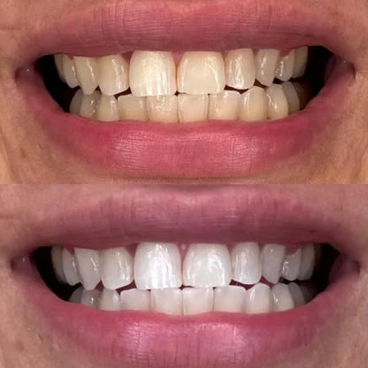 Crest 3D - 3 in 1 Whitening Vitalizing fresh